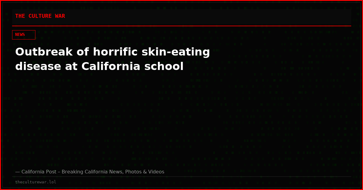 Outbreak of horrific skin-eating disease at California school