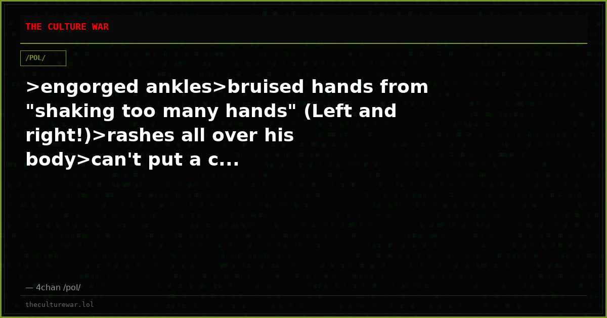 >engorged ankles>bruised hands from "shaking too many hands" (Left and right!)>rashes all over his body>can't put a c...