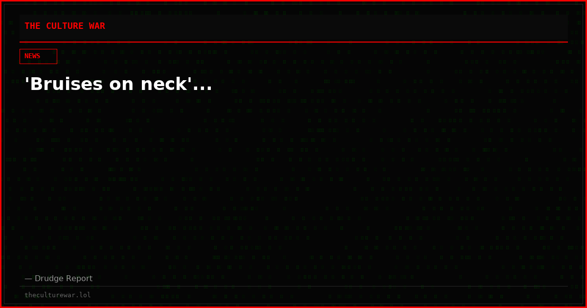 'Bruises on neck'...
