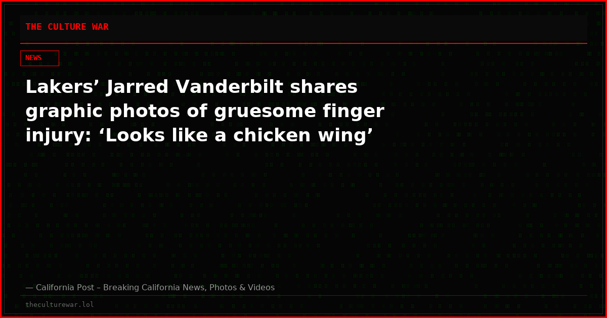 Lakers’ Jarred Vanderbilt shares graphic photos of gruesome finger injury: ‘Looks like a chicken wing’