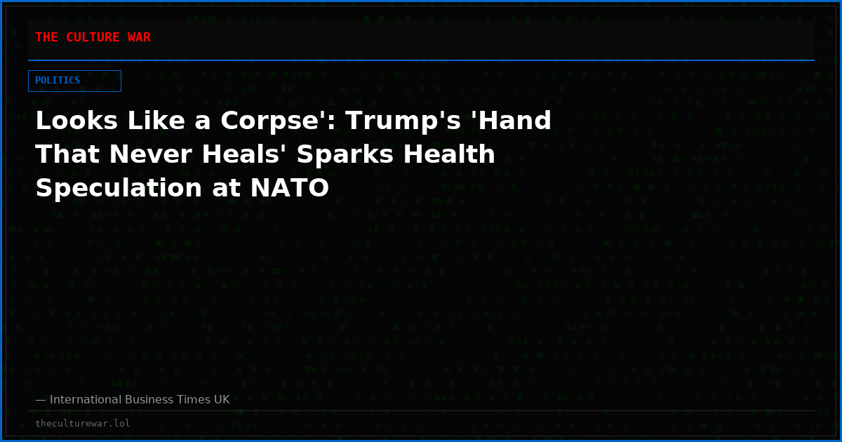 Looks Like a Corpse': Trump's 'Hand That Never Heals' Sparks Health Speculation at NATO