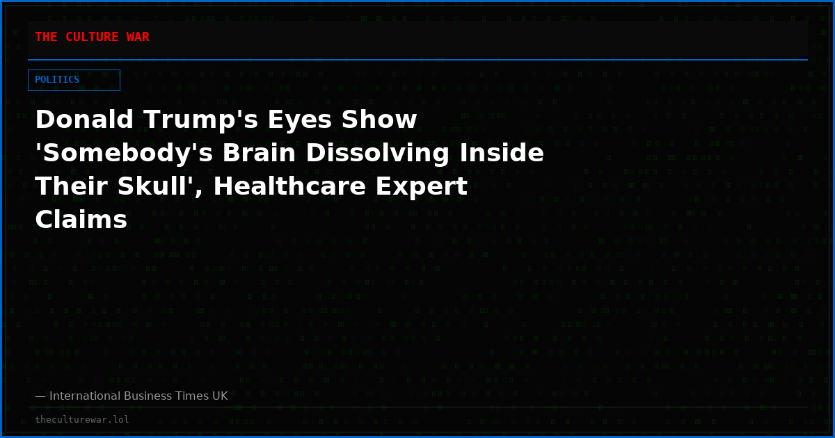 Donald Trump's Eyes Show 'Somebody's Brain Dissolving Inside Their Skull', Healthcare Expert Claims
