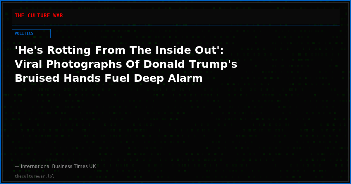 'He's Rotting From The Inside Out': Viral Photographs Of Donald Trump's Bruised Hands Fuel Deep Alarm