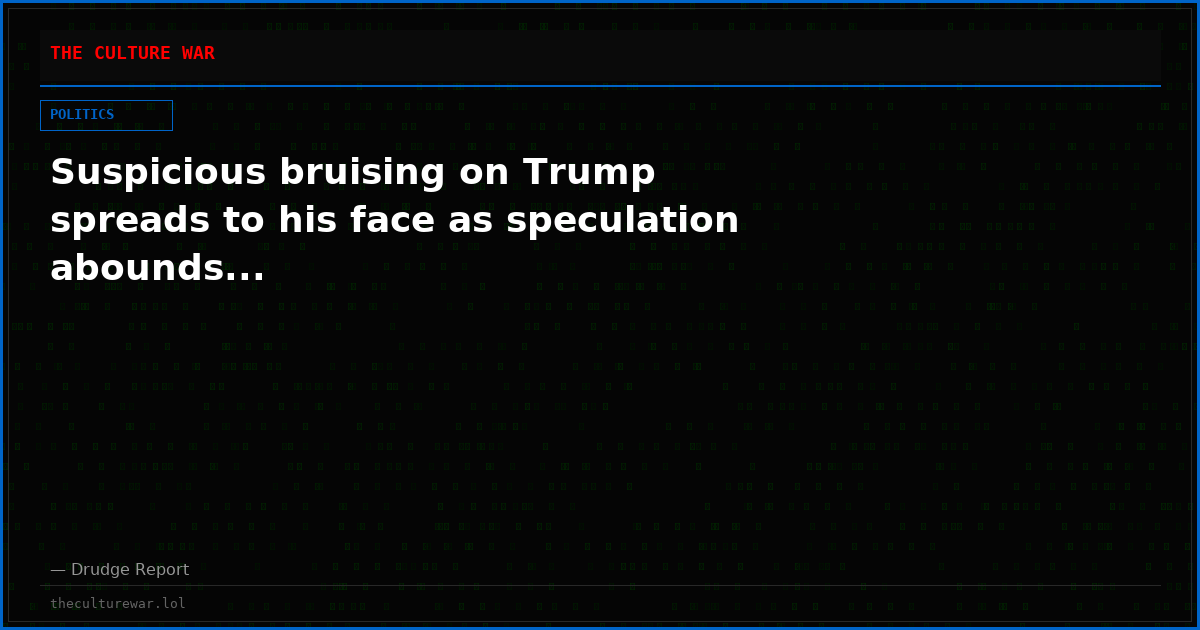 Suspicious bruising on Trump spreads to his face as speculation abounds...